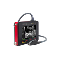 DRAMINSKI iScan 2 Ultrasound Scanner (with 1 convex probe)