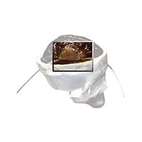 True Phantom Solutions HA-A01 Hematoma