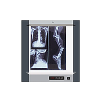 Micare MG-01 Medical film viewer (360x440mm)