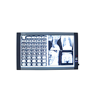 Micare ZG-2C Medical film viewer (＞8000k, 60W)