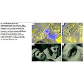 Multispectral camera for artifact quality analysis