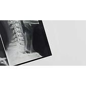 External Exposure, Radioactive Contamination, and Internal Exposure: Key Differences