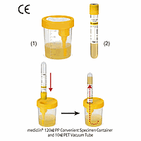 Daihan medical DM.Tub3001 Vacuum Tube, for Urine Sample PET, with PP Cap, Sterile, 10㎖, Φ13×h106mm