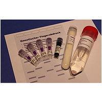 PHYWE KLA-530-120 Kit Forensic DNA Fingerprinting